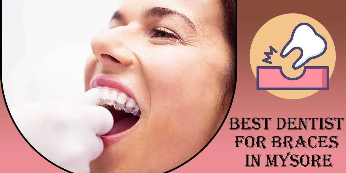 Best Dentist for Braces in Mysore | Best Dental Clinic