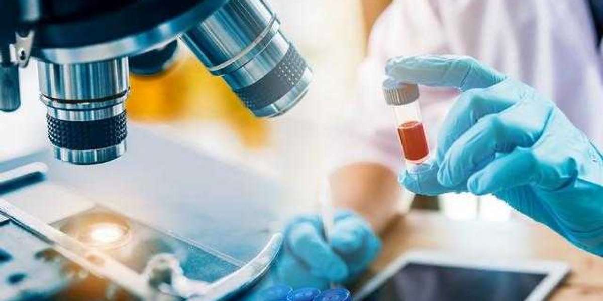 Pharmaceutical Analytical Testing Outsourcing Market Report 2023-2028