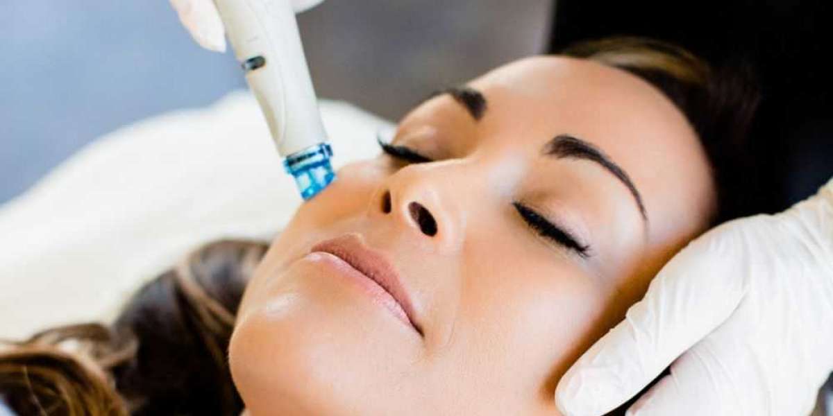 Microneedling: Unlocking the Benefits of Collagen Induction Therapy