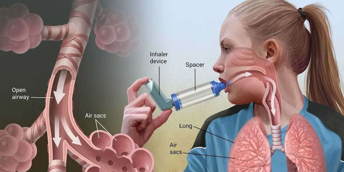 Asthma Inhaler Device Market Outlook Report includes Global Industry Size & Forecasts